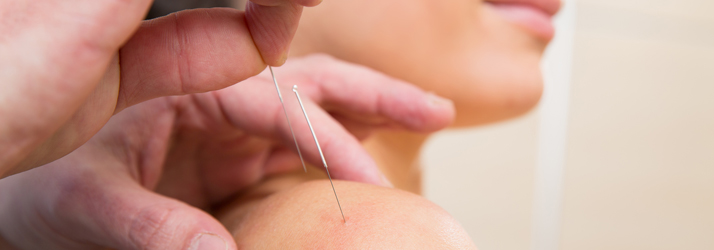 Chiropractic Bloomingdale IL Acupuncture